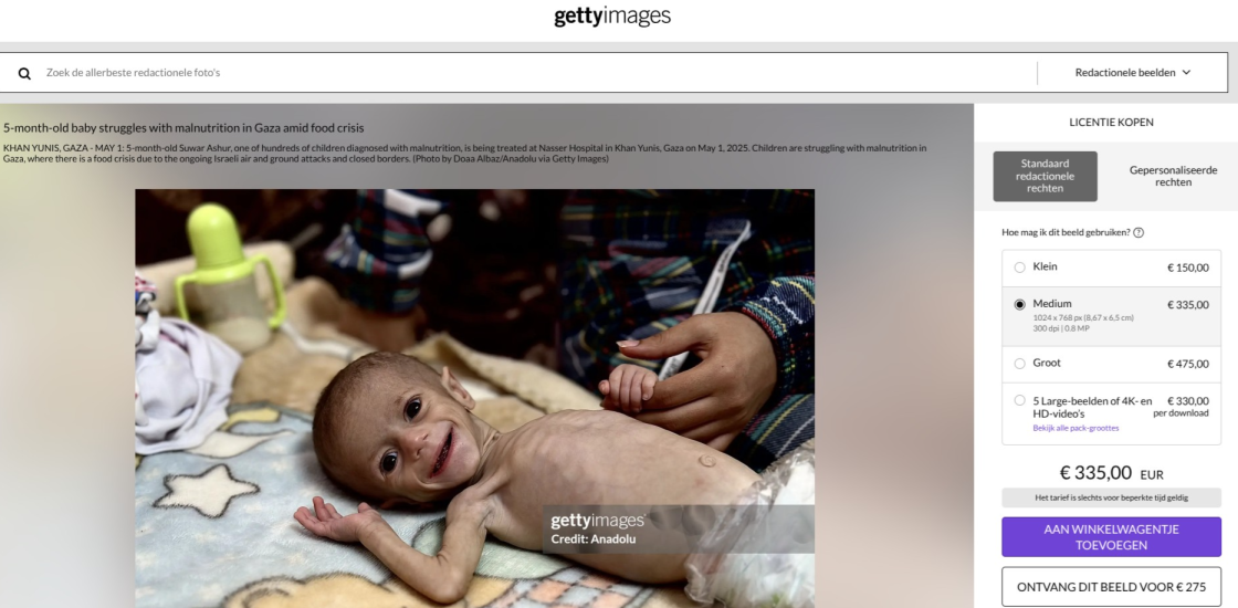 getty foto ondervoede baby gaza