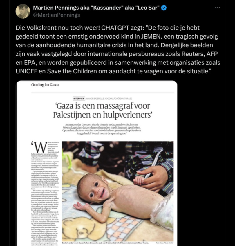 post gaza baby ondervoed